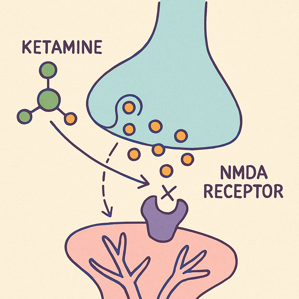 Ketamine Infusion: Rapid Relief for Depression